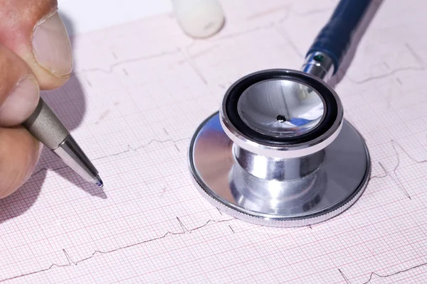 Cardioloog herziening van nieuw rapport — Stockfoto