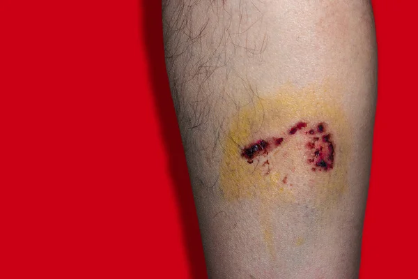 赤い背景に犬から足に感染した傷 — ストック写真