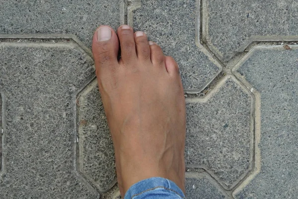 Close up of women 's foot isolated on a concrete floor background. Нога уродливая, темно-коричневая, и на ней видны волосы и вены. Никакого маникюра. без маникюра ногтей. — стоковое фото