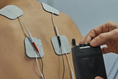 Genç bir kadına fizyoterapide elektro uyarı. Fizyoterapi merkezinde omzunu kontrol et. Onluk terapi