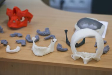 Alt çene bir adam, bir 3d printerlere harcama maddeler fotopolimer malzemesinden Tarihinde yaratılmıştır. Stereolitografi 3d yazıcı, Uv ışık altında sıvı photopolymerization teknoloji. Modern tıp teknolojileri