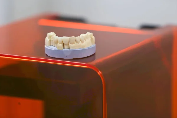 The lower jaw of a man, created on a 3d printer from a photopolymer material. Stereolithography 3D printer, technology of liquid photopolymerization under UV light. Modern medical technologies — Stock Photo, Image