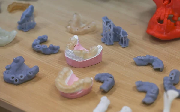 The lower jaw of a man, created on a 3d printer from a photopolymer material. Stereolithography 3D printer, technology of liquid photopolymerization under UV light. Modern medical technologies — Stock Photo, Image