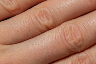 İnsan derisi yakın çekim makro fotoğrafı