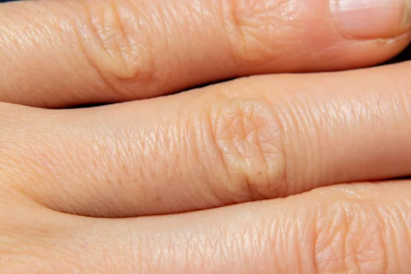 Human skin closeup macro photo — 스톡 사진