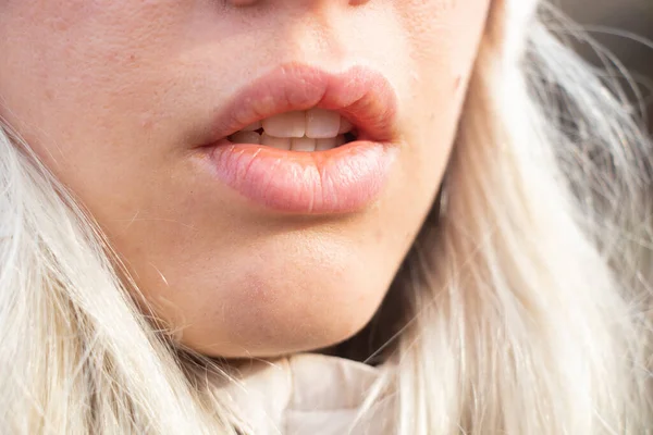 Mouth Young Girl Outdoors Closeup Afternoon Sun — Stock Photo, Image