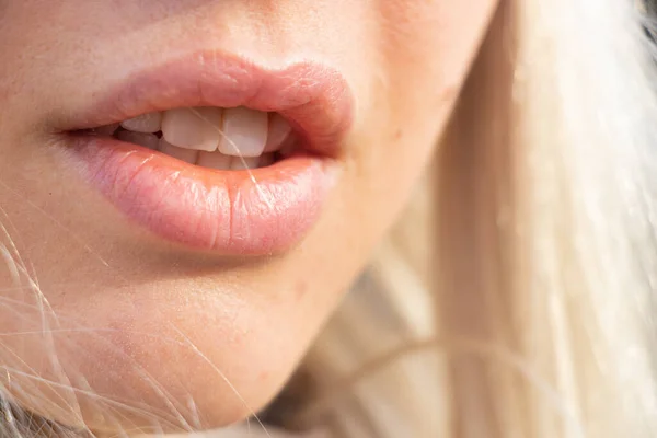 Bocca Una Giovane Ragazza All Aperto Primo Piano Sole Del — Foto Stock