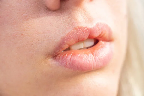 Mouth Young Girl Outdoors Closeup Afternoon Sun — Stock Photo, Image