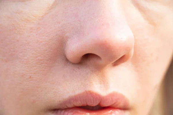 Στόμα Και Μύτη Ενός Νέου Κοριτσιού Εξωτερικούς Χώρους Closeup — Φωτογραφία Αρχείου