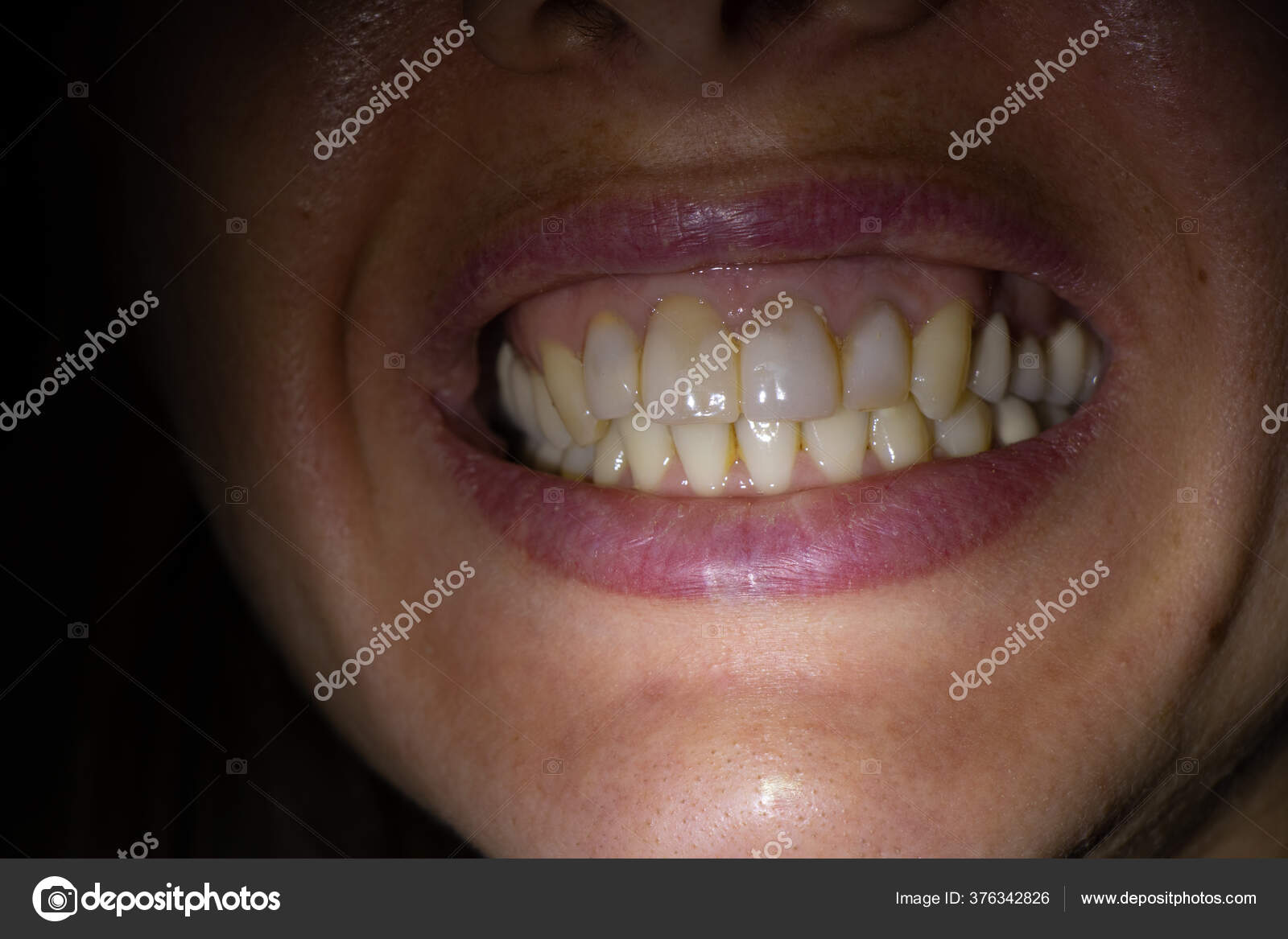 Femaleteeth cruel girls