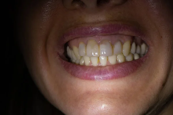 Usta Samicy Ciemności Oświetlone Latarnią — Zdjęcie stockowe