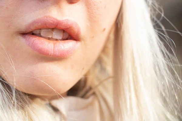 Mouth Young Girl Outdoors Closeup Afternoon Sun — Stock Photo, Image