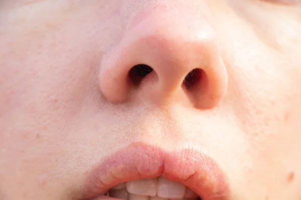 Στόμα Και Μύτη Ενός Νέου Κοριτσιού Εξωτερικούς Χώρους Closeup — Φωτογραφία Αρχείου