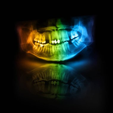 Color X-Ray Skull Jaw Tooth clipart
