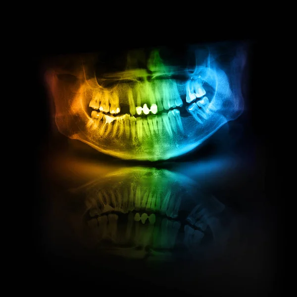 Color X-Ray Skull Jaw Tooth