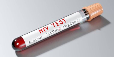 HIV virüsü / AIDS - test tüpü, kan testi - 3 boyutlu illüstrasyon