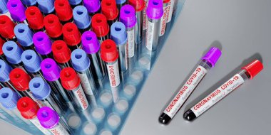 Coronavirus, SARS-CoV-2, Covid-19 virüsü - test tüpleri, kan testleri - 3 boyutlu illüstrasyon