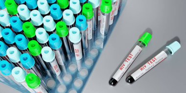 HIV virüsü / AIDS - test tüpleri, kan testleri - 3 boyutlu illüstrasyon