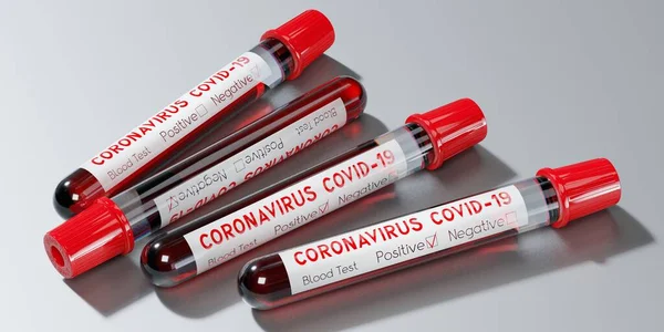 Coronavirus Sars Cov Covid Virüsü Test Tüpleri Kan Testleri Boyutlu — Stok fotoğraf