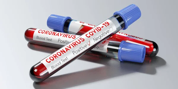 Coronavirus Sars Cov Covid Virus Reagensglas Blodprøver Illustration - Stock-foto