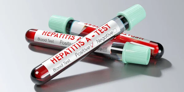 Virus Hepatitidy Zkumavky Krevní Testy Ilustrace — Stock fotografie