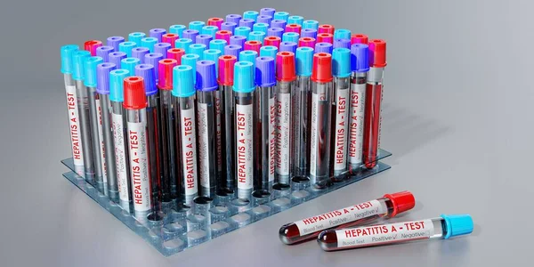 Hepatitis Virus Reagenzgläser Bluttests Illustration — Stockfoto