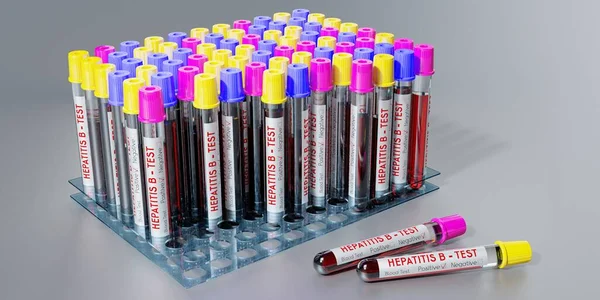 Wirus Zapalenia Wątroby Typu Probówki Badania Krwi Ilustracja — Zdjęcie stockowe