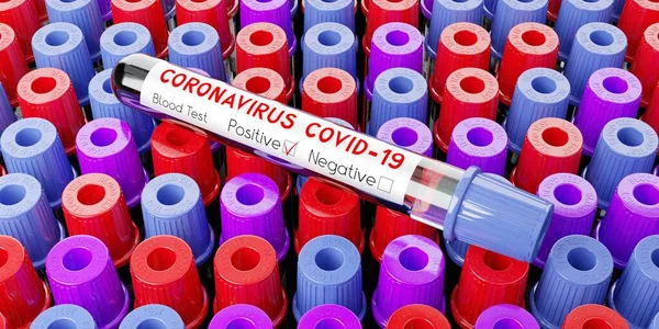 Coronavirus Sars Cov Ιός Covid Δοκιμαστικοί Σωλήνες Εξετάσεις Αίματος Τρισδιάστατη — Φωτογραφία Αρχείου