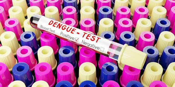 Dengue virus - test tubes, blood tests - 3D illustration