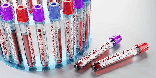 Coronavirus Sars Cov Covid Vírus Kémcsövek Vérvizsgálatok Illusztráció — Stock Fotó