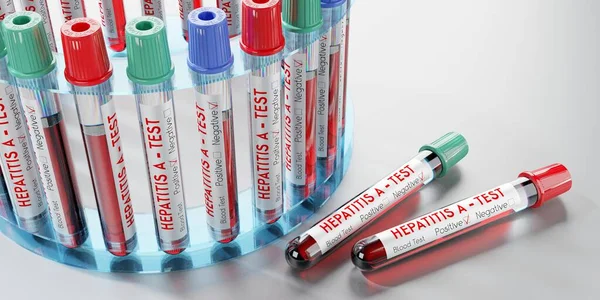 Virus Dell Epatite Provette Esami Del Sangue Illustrazione — Foto Stock