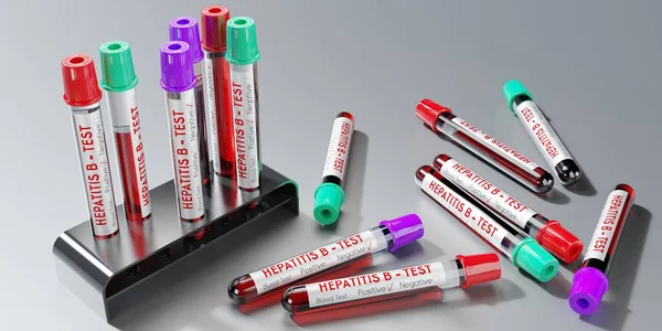 Hepatit Virüsü Test Tüpleri Kan Testleri Boyutlu Illüstrasyon — Stok fotoğraf