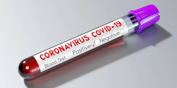 Coronavirus Sars Cov Covid Virüsü Test Tüpü Kan Testi Boyutlu — Stok fotoğraf