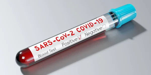 Coronavirus Sars Cov Virusul Covid Tub Testare Test Sânge Ilustrație — Fotografie, imagine de stoc