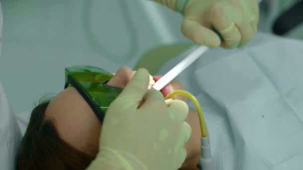 Tandarts verwijdert stof uit tand door apparatuur — Stockvideo