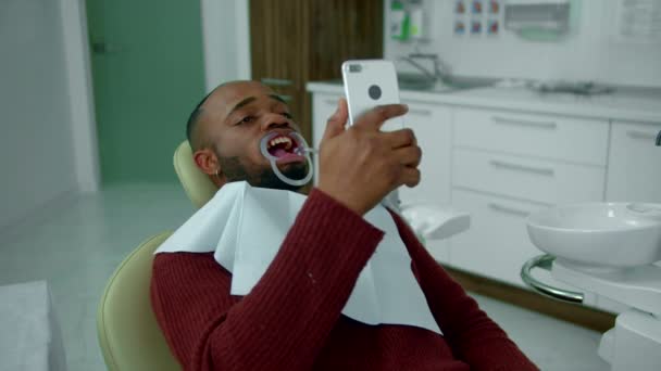 Facet z ekspanderem dentystycznym w ustach robi selfie — Wideo stockowe