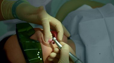 Doktor hastanın dişindeki maddeyi çıkarır.