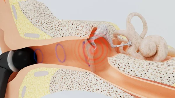 3d rendere cuffie in orecchio e condotto uditivo. Illustrazione 3d — Foto Stock