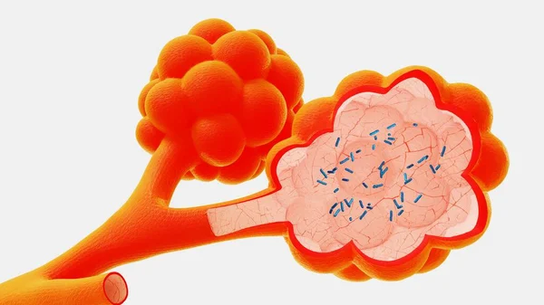 3d render alveoli in the context of the release of viruses and bacteria — Stock Photo, Image