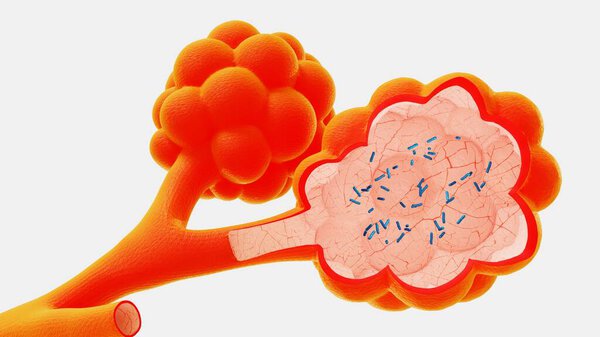 3d рендер альвеол в контексте выпуска вирусов и бактерий
