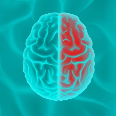 Parlayan insan beyni