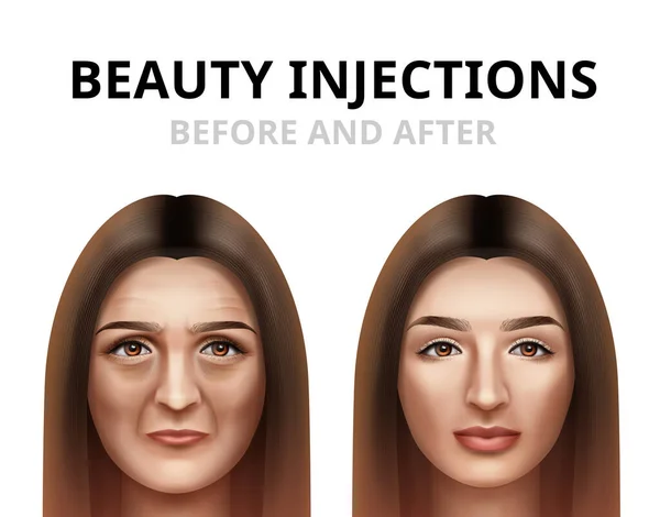 Realista antes y después de la ilustración vectorial de la mujer que tiene inyección de belleza facial . — Archivo Imágenes Vectoriales