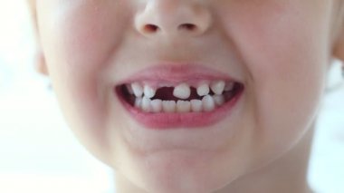 Çocuk sallanan bir bebek dişi gösteriyor. Diş dilini sallıyor. Dişe eliyle dokunuyor. Dişsiz gülümseme. Kız kendi dişini çekmeye çalışıyor. Kapat.