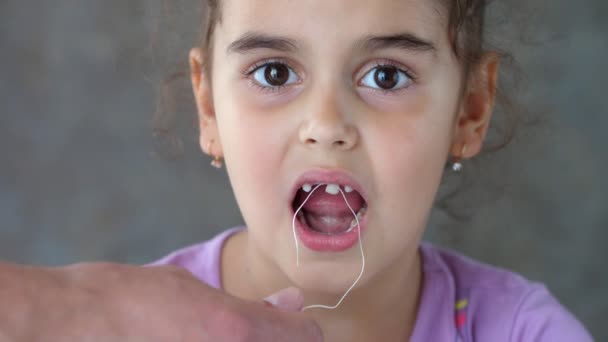 Le mani di un adulto tirano il filo legato al dente dei bambini. Tentativo fallito di rimuovere un dente. Tira fuori il dente con un filo. Togli il dente a casa. Da vicino. — Video Stock