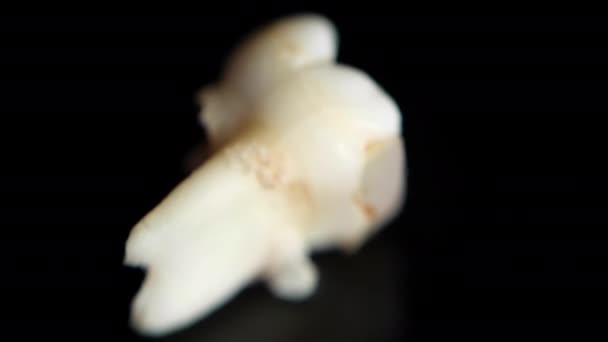 Ausgezogener Babyzahn auf schwarzem Hintergrund. Extrahierte Zähne isoliert auf schwarz. Makro — Stockvideo