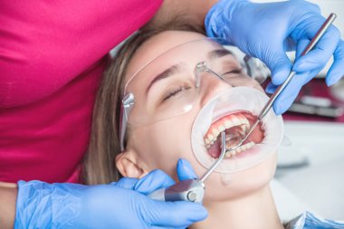 Bir dişçi hastayı muayene eder, hastaya yakın çekim yapar, ağzı açık bir şekilde dişçi eşyasının yanına koyar.