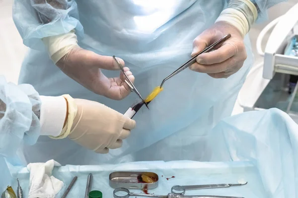 Closeup of the hands of a dentist surgeon who cuts off the barrier membrane during dental implantation — Stock Photo, Image