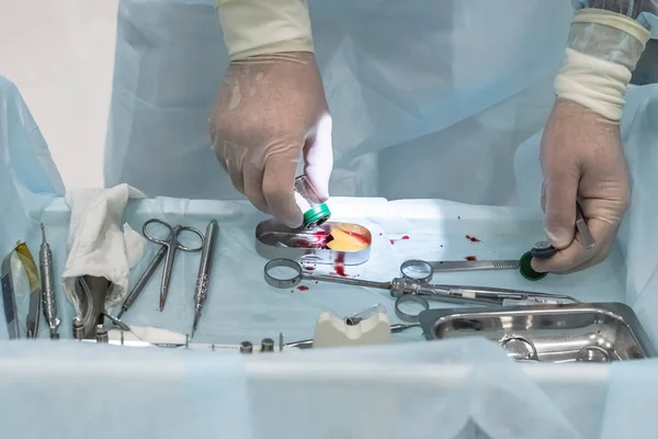 Diş implantasyonu sırasında bariyer zarını kesen bir dişçinin elleri.