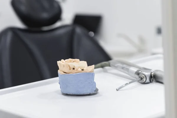 Prótesis dentales en implantes, mandíbula artificial con prótesis en la mesa en el consultorio dental —  Fotos de Stock