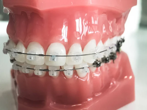 Bağlı tel tel ile insan çene modeli. Diş ve ortodontik ofis ve laboratuvar sunum aracı, diş bakımı ve Ortodonti kavramı
